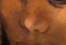 portaitnose.gif