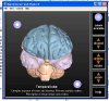 brain.jpg